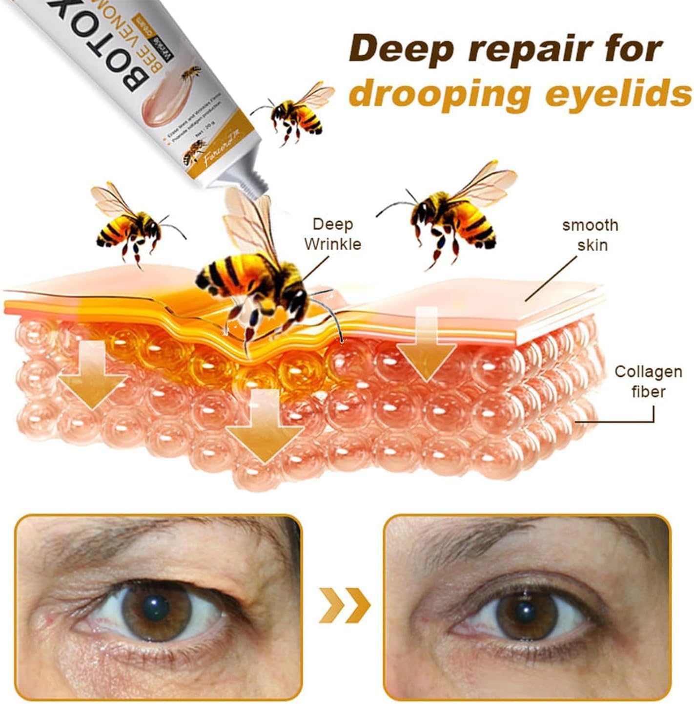Boto-x Bee Venom Cream Wrinkle Firming Removal,Lifting,Moisturizing,& Recovery for All Skin Type,Anti-Aging Bee Venom Creaming,Face Cream-Moisturiser (1pcs, regular)