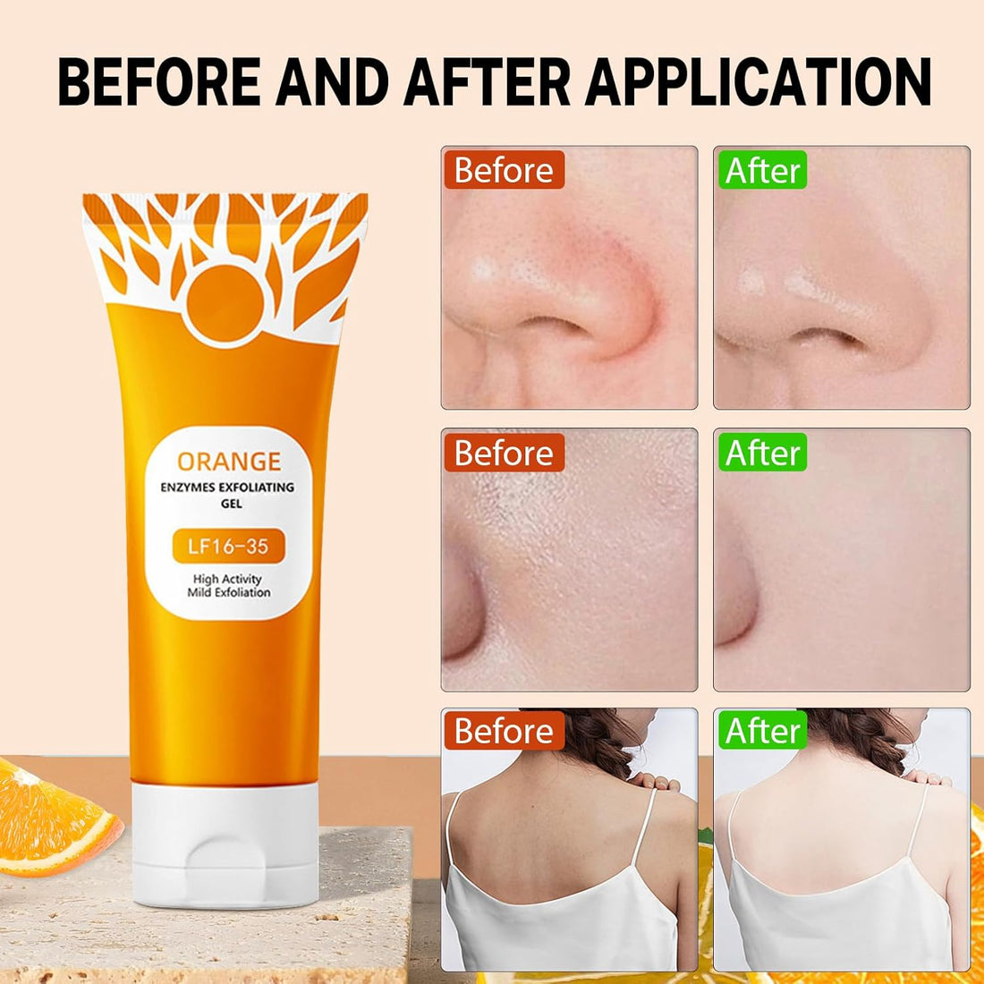 2Pcs Orange Exfoliating Gel For Face & Body,2026 Exfoliating Cleansing Gel Scrub,Pore Orange Peeling Scrub,Deep Clean Pores,Remove Blackheads & Moisturize Skin,All Types Skin