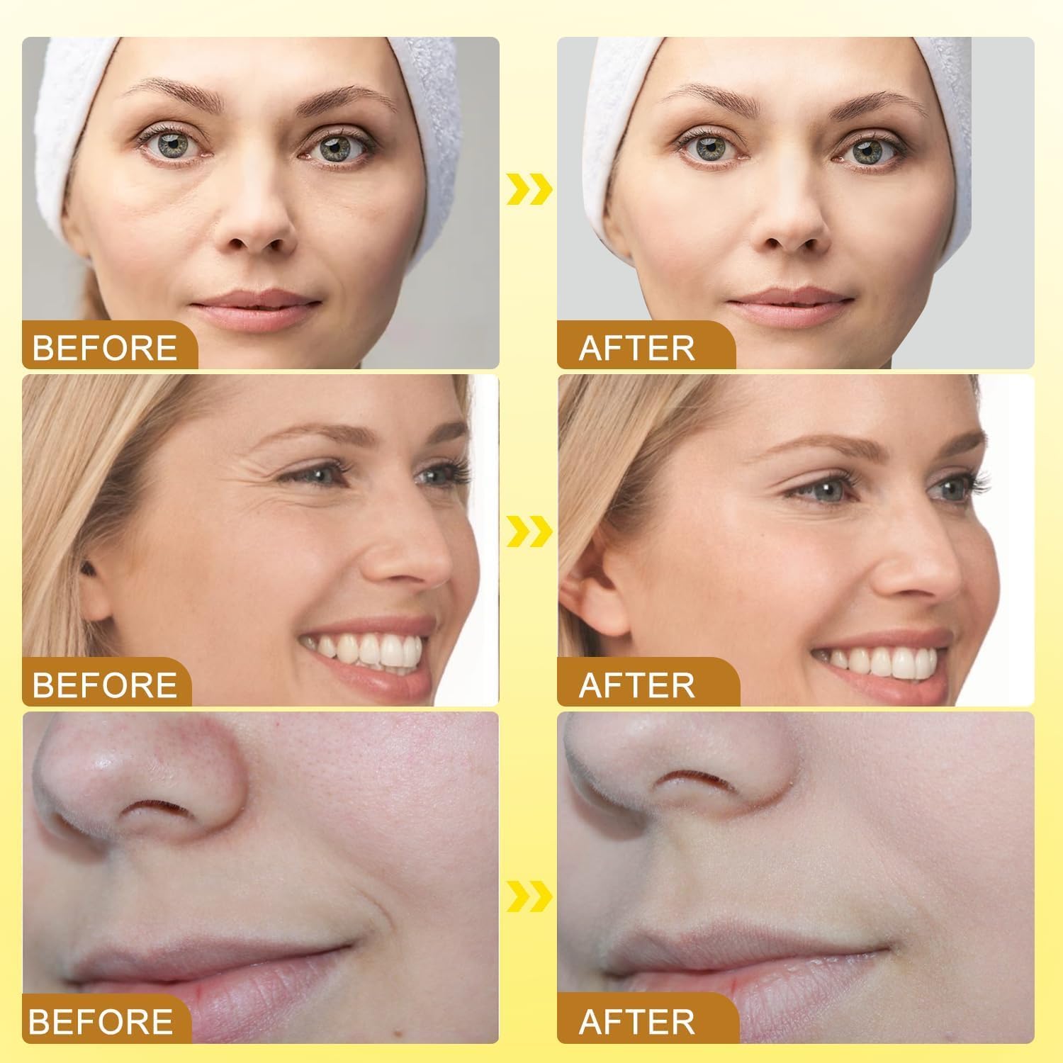 Boto-x Bee Venom Cream Wrinkle Firming Removal,Lifting,Moisturizing,& Recovery for All Skin Type,Anti-Aging Bee Venom Creaming,Face Cream-Moisturiser (1pcs, regular)